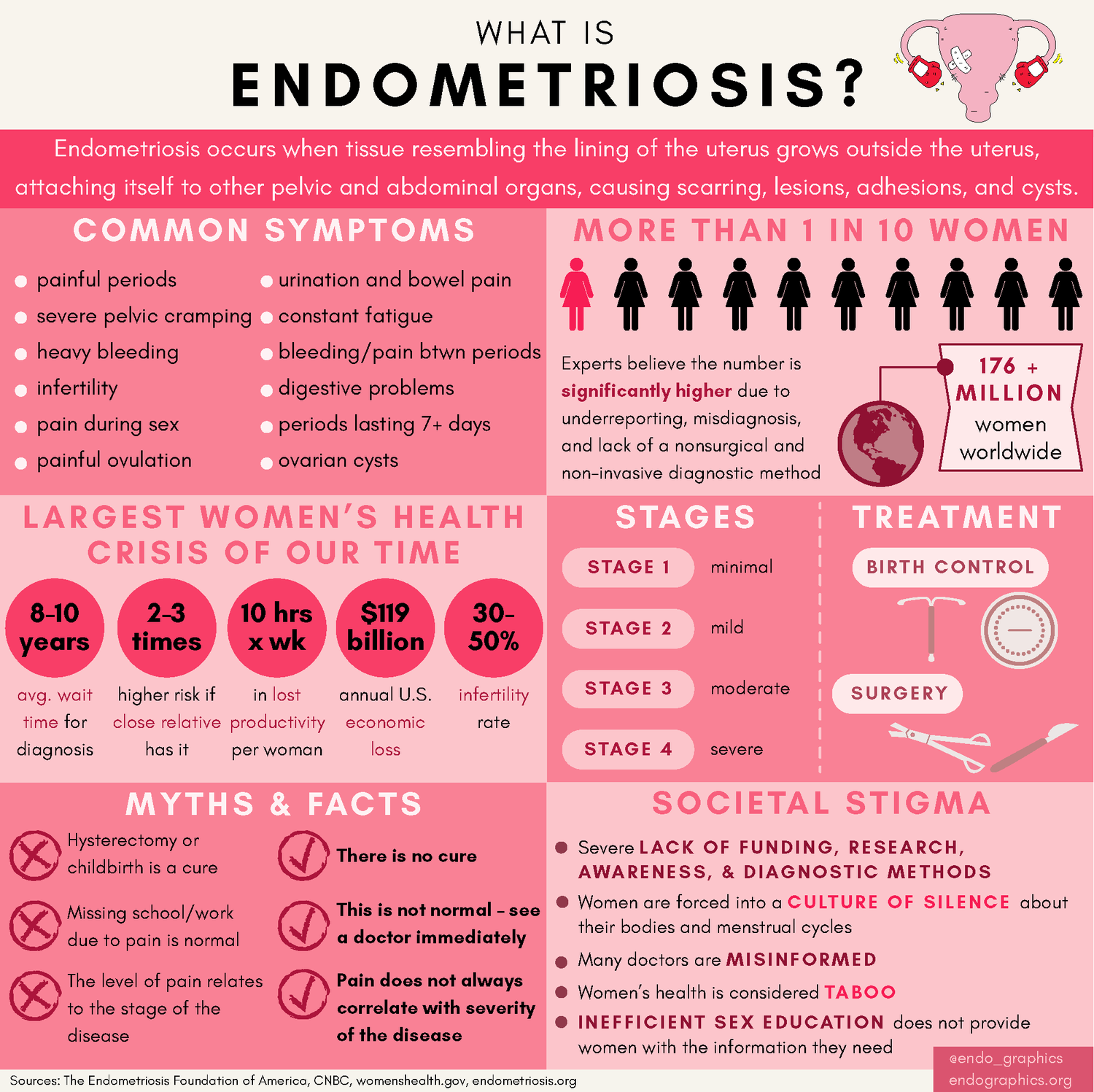 ENDOMETRIOSIS: WHAT IS IT?